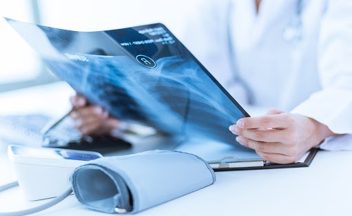 Công nghệ AI hỗ trợ đọc phim chụp X-quang phổi giúp phát hiện các ca lây nhiễm COVID-19 nhanh hơn và tiết kiệm nhân lực